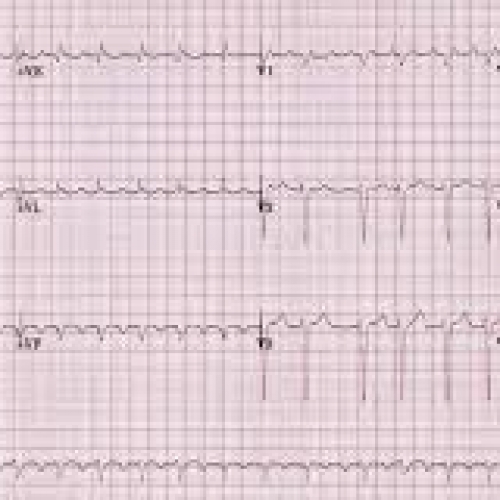 Elettrocardiogramma Terni.