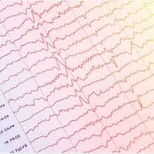 Elettroencefalogramma a domicilio Cosenza.